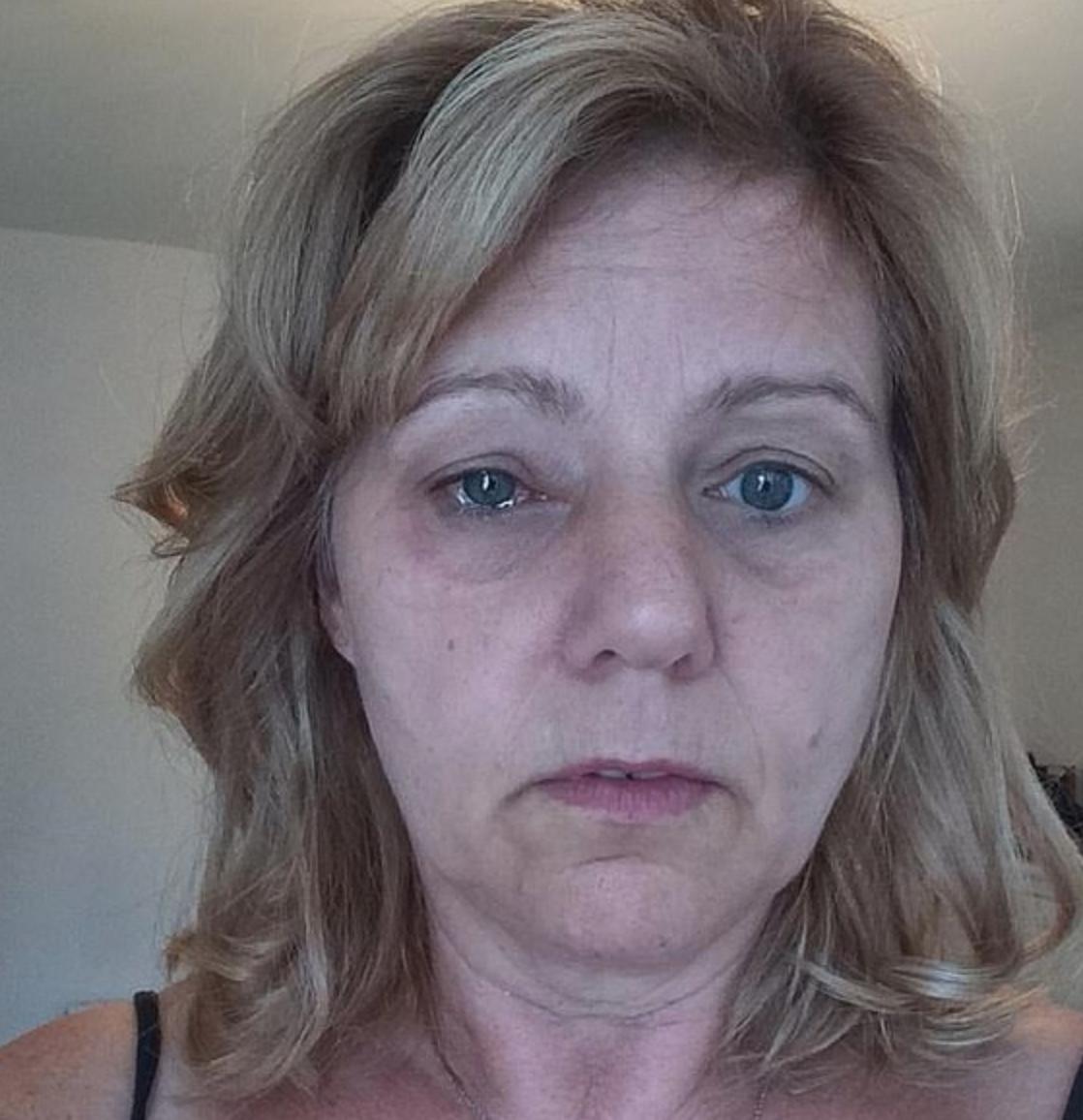 英大妈把香水喷眼睛里很难受，去医院寻求帮助，大夫：你得眼癌了