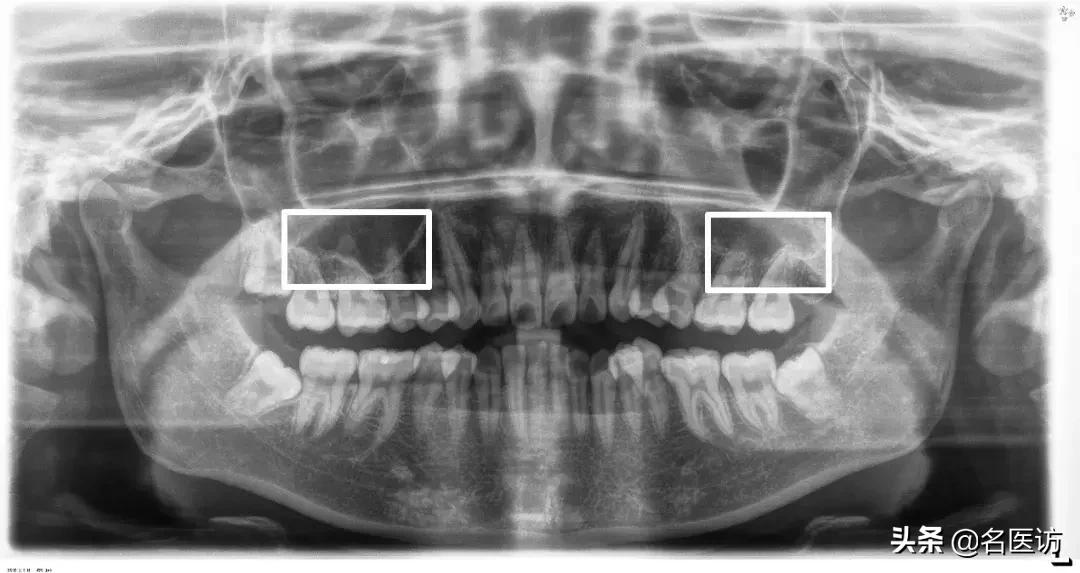 矫正牙科普馆,矫正牙齿科普知识