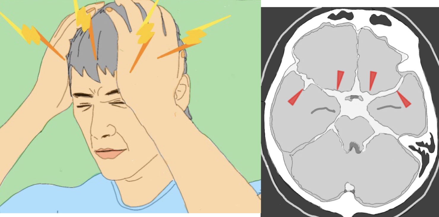 24岁小伙熬夜,24小伙熬夜玩手差点瘫痪