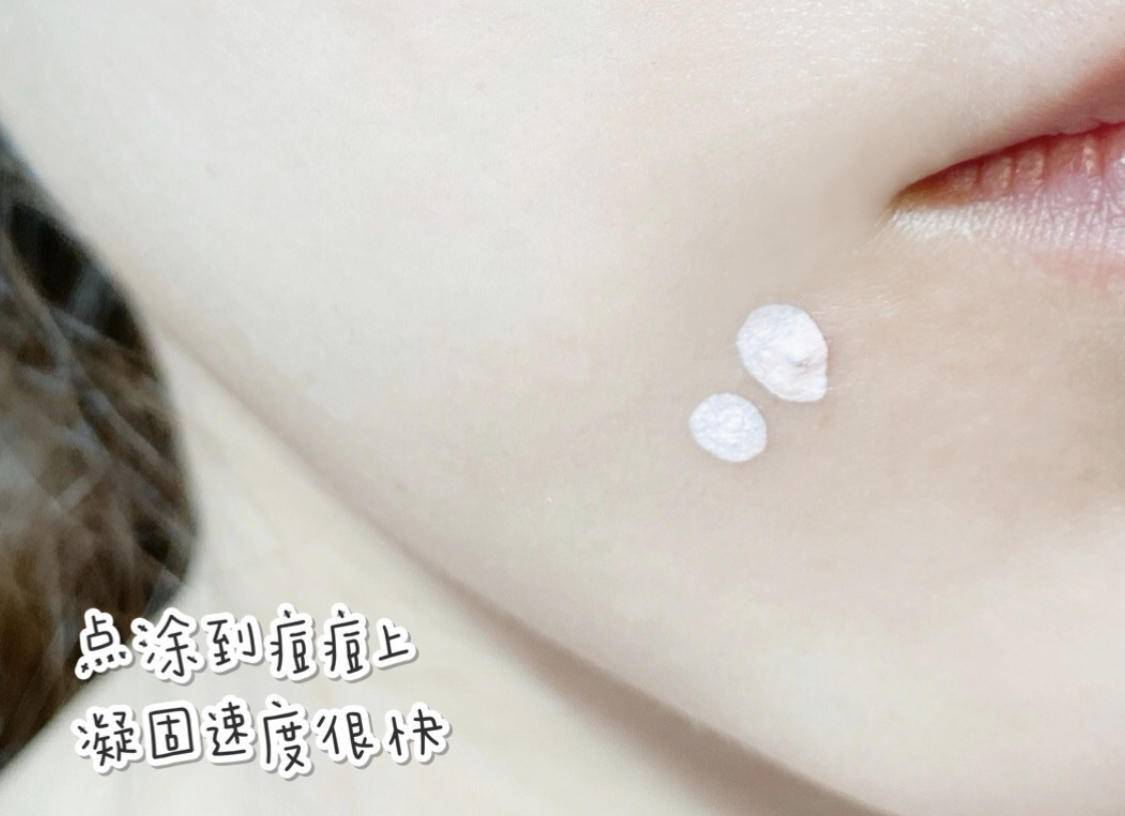 痘痘反反复复又红又疼又痒,痘痘反反复复有一层皮