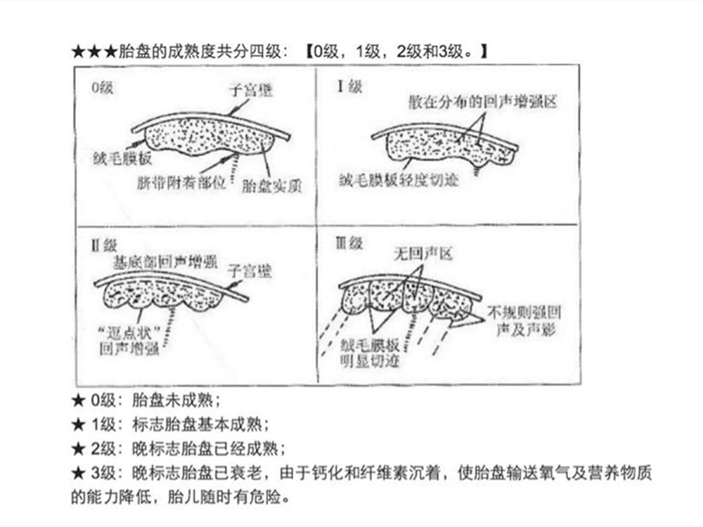 孕期做四维彩超包括检查心脏吗,孕期四维彩超查些什么项目