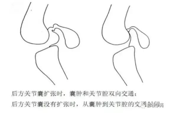 膝关节疼痛的问题各种各样的图片,膝关节疼痛的16种最常见原因速查