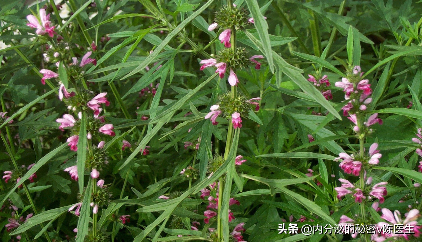 桥本氏甲状腺炎中医怎么治疗好呢,桥本氏甲状腺炎伴甲亢中医治疗