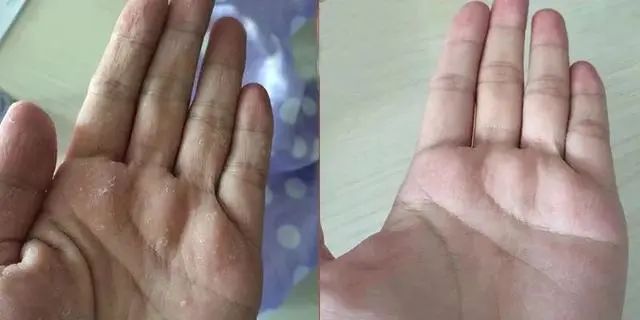 日本敏感皮肤面霜,日本人五合一面霜