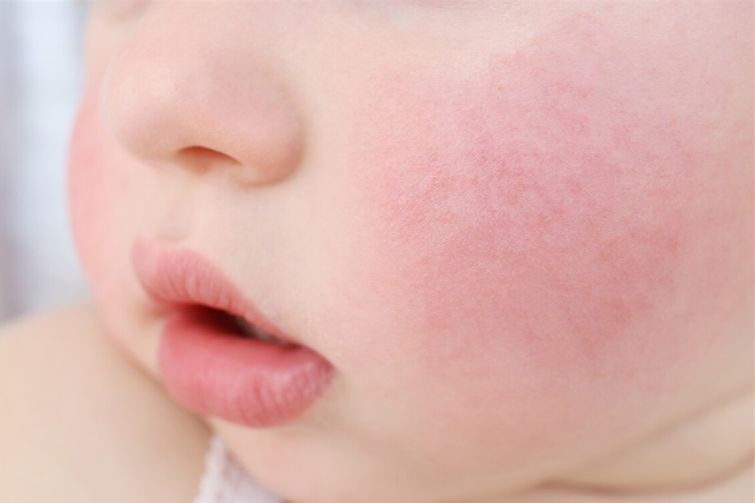 不想让皮肤继续变黄变老,儿童冬季面部干皮护肤推荐