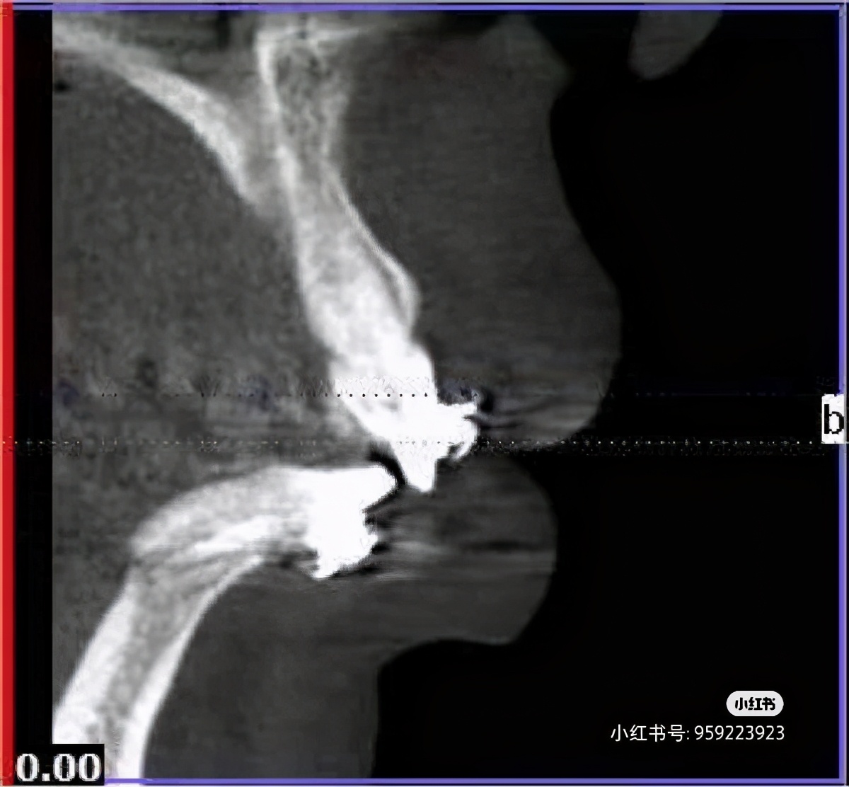 维乐口腔和维乐中泽口腔,福州维乐中泽口腔门诊