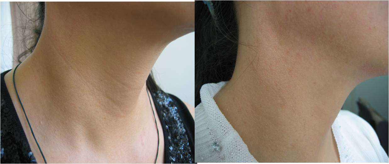 一条颈纹老十岁教你一招淡化,年度最佳颈纹霜