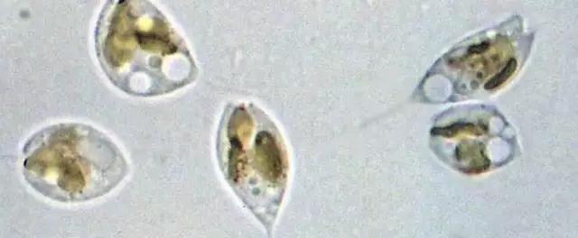 水产养殖藻类老化是怎样的,水产养殖显微镜下各种藻类