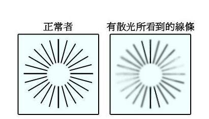 散光近视有什么矫正的方法吗,近视散光和近视加散光有什么区别