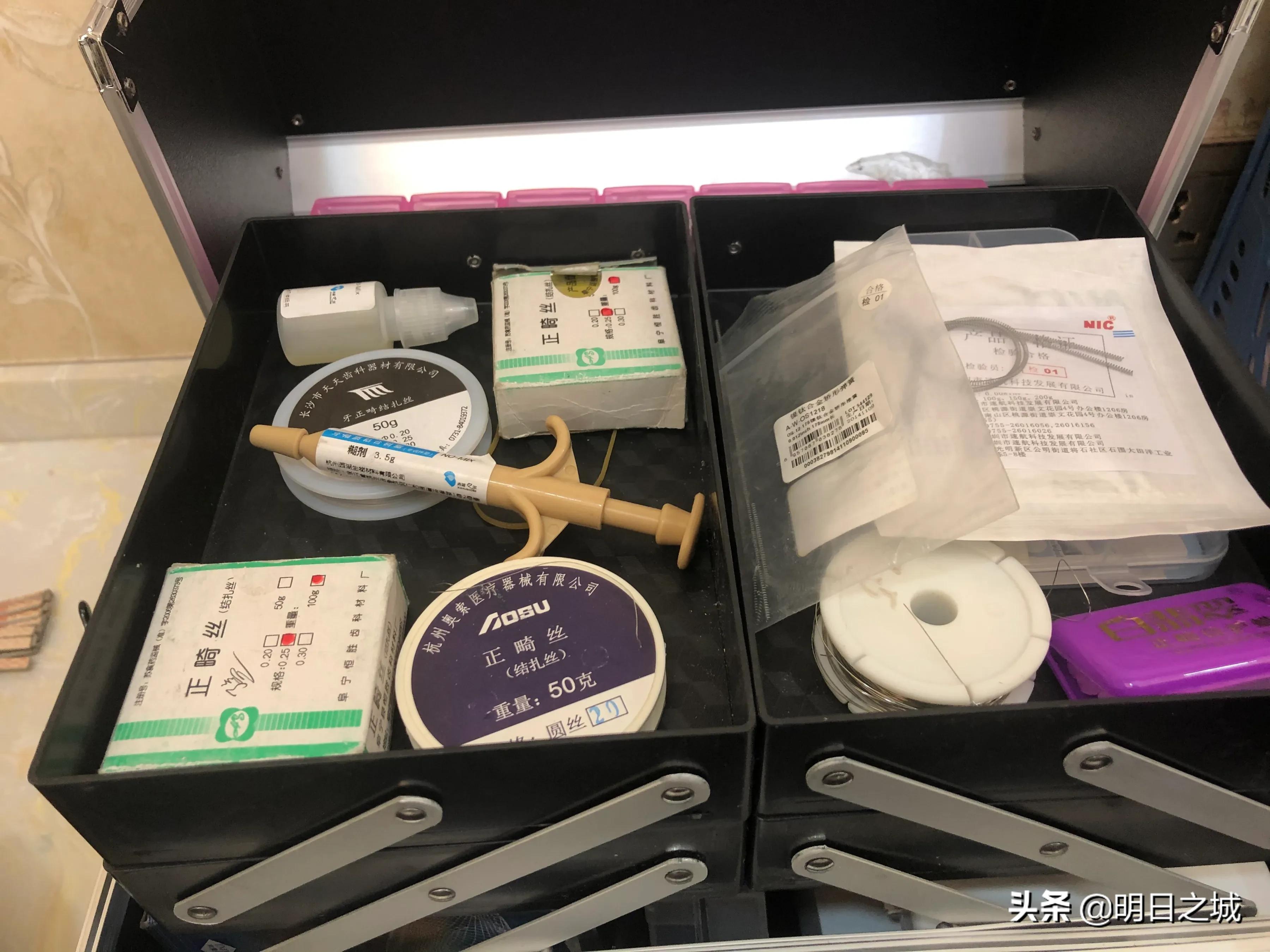 15岁女生矫正牙齿戴牙套全过程,12岁女孩牙齿矫正四颗牙一起拔牙