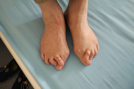 给骨病关节炎患者忠告的句子,给生病患者的忠告