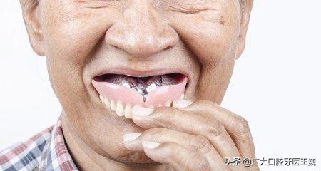 老人活动假牙戴上了牙齿疼,老人戴活动假牙总是掉怎么办