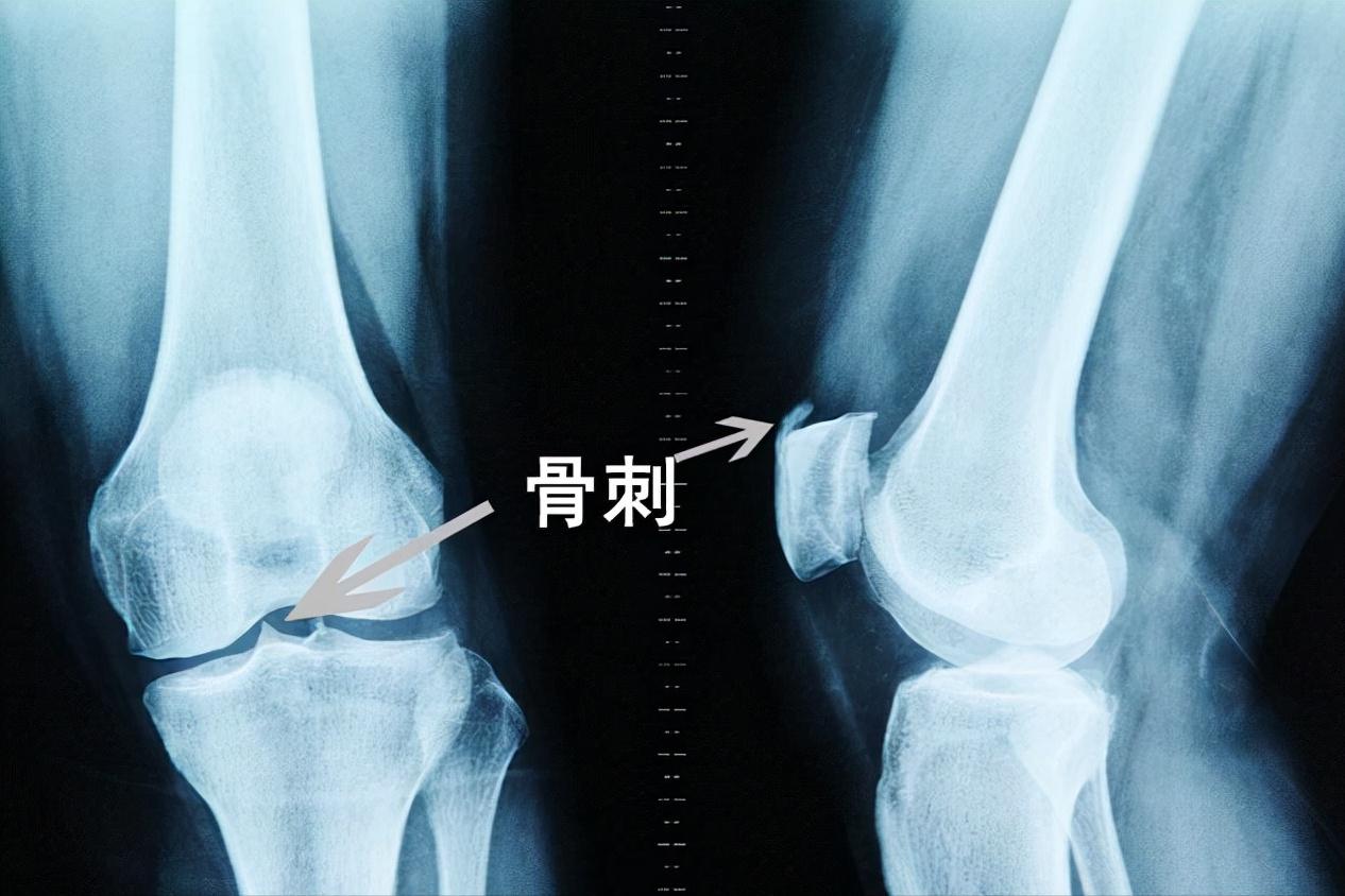 采访医生说有几种疾病能治愈,医生对病人根治不彻底怎么办