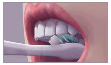 接吻蛀牙会口臭吗,牙齿黄口臭影响接吻吗