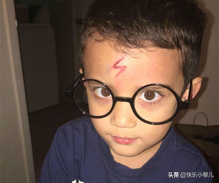 萌娃不小心撞到脑袋摔一跤,萌娃不小心撞到脑袋摔了一跤