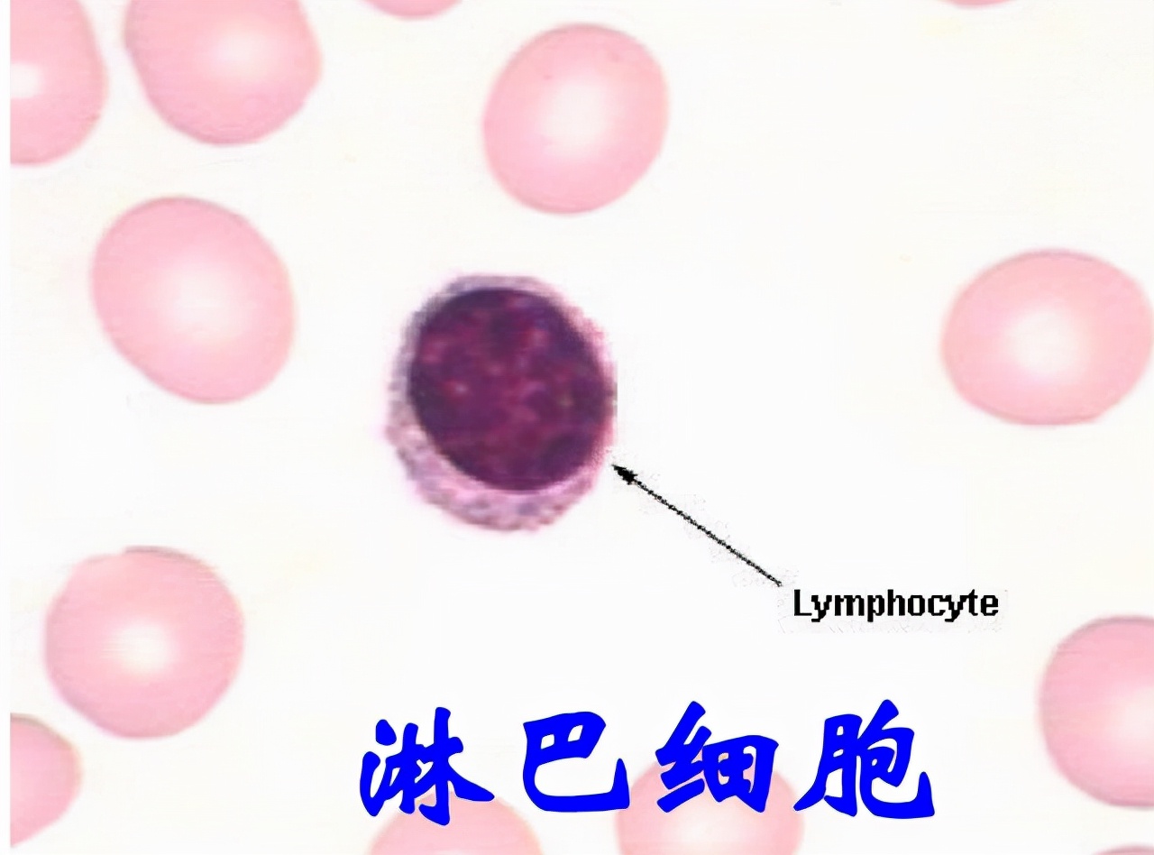 血常规检查各项指标都高什么原因,血常规检查3项高有什么病
