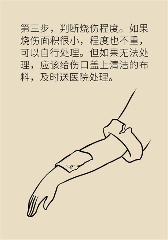 烧伤有水泡创面如何处理,烧伤烫伤起泡怎么处理