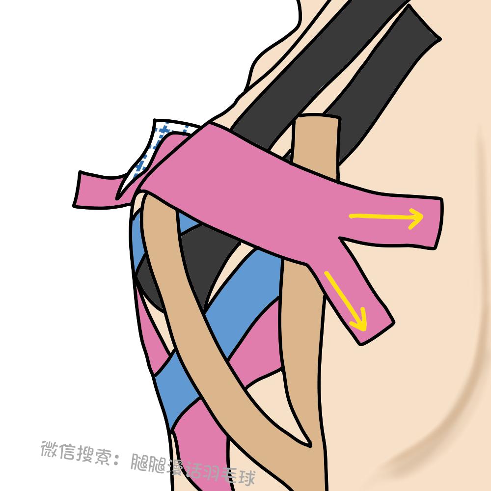 打球后肩膀痛怎么缓解,打球肩膀疼一招搞定