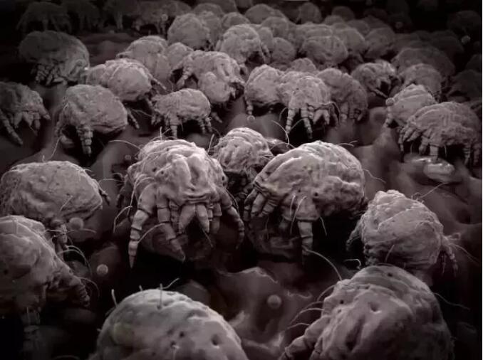 清理黑头痘痘的治愈过程,祛痘痘痘印黑头用什么好