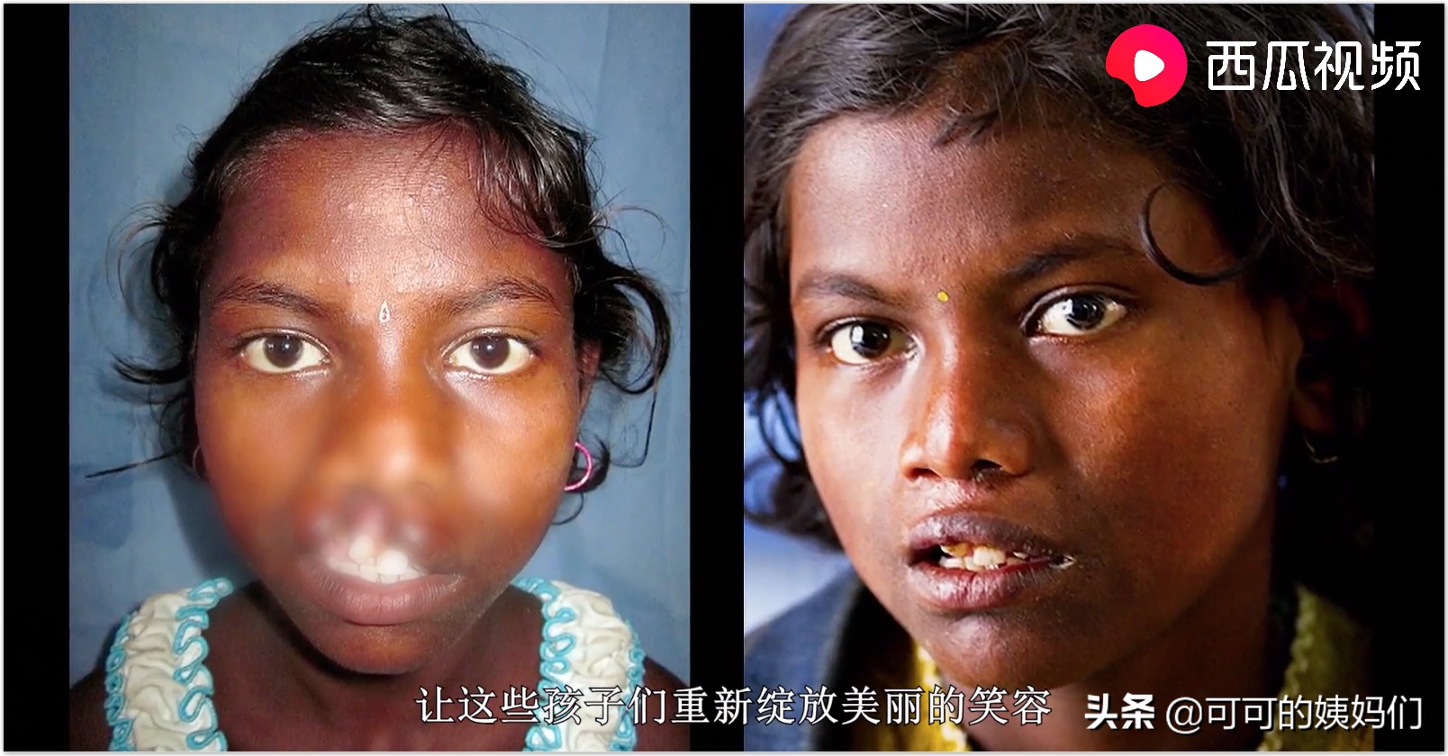 双胞胎受孕过程科普动画,揭秘试管婴儿受孕全过程