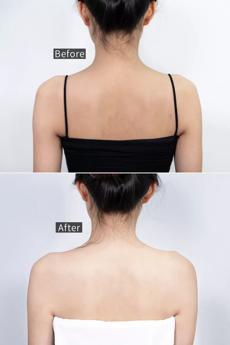 王鸥露背照片,王鸥最新露背写真