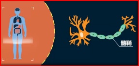 多发性硬化有新药了吗,多发性硬化新药上市