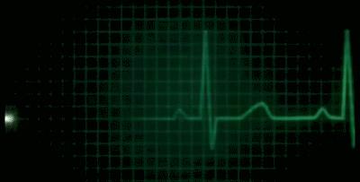 房颤时如何正确测量心率和脉率,房颤病人心率和脉率测量方法