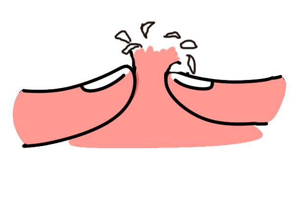 黑头挤到一半挤不出来,黑头挤不完吗