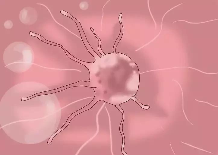 18岁女孩感染了hpv正常吗,18岁女孩得hpv16阳性