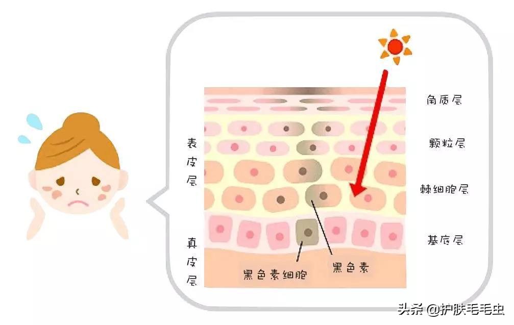 脸上长斑是什么原因怎样能调理好,什么原因导致脸上长斑要怎么治疗