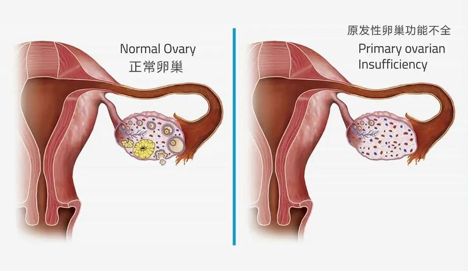 35岁的年龄40岁的卵巢正常吗,为什么女人30多岁卵巢像50多岁