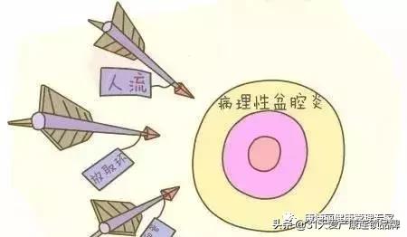 小腹坠胀感觉有东西要掉出来,小腹坠胀有粘液怎么回事