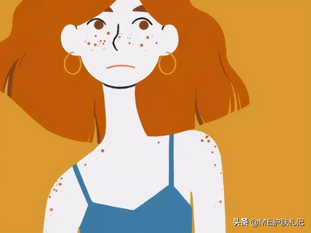 胶原蛋白可以淡化色斑吗,胶原蛋白肽可以淡化色斑吗