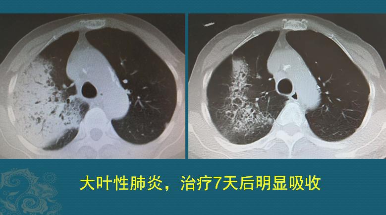 上帝造人时给我们造的东西,上帝在造人时给人装了两个口袋