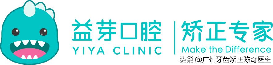 戴牙套会有下颌线,戴牙套的时候人会变丑吗