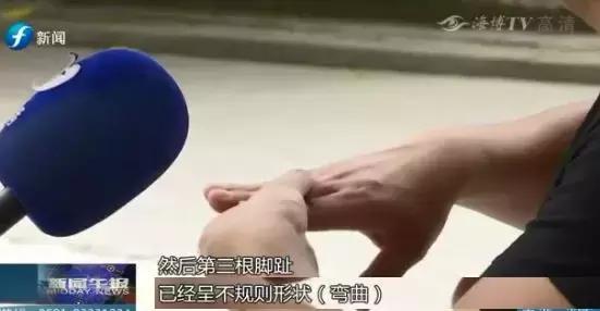 8岁女童被外卖车撞伤,小女孩被外卖员撞后续处理结果