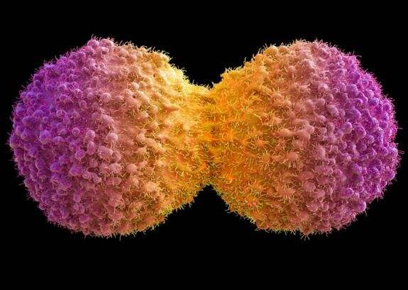 肾癌的早期怎么治疗,如何早发现肾癌的出现