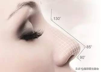 鼻子是怎么垫高的,鼻子垫高点更完美了
