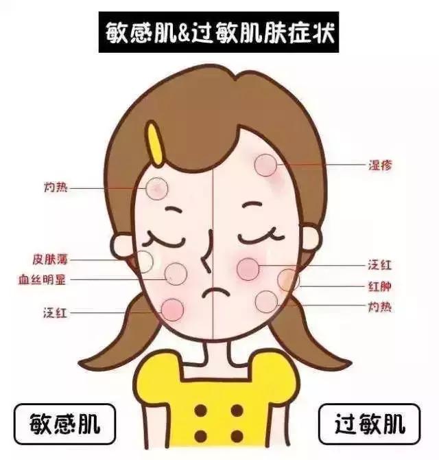 去红血丝的有效方法,去红血丝最好的方法最简单有效的