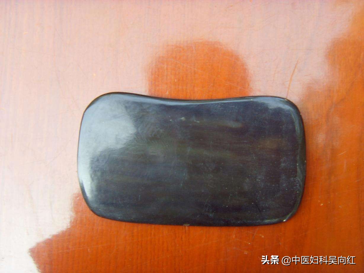 痛则不通最全经络图,痛则不通怎样才能通则不痛