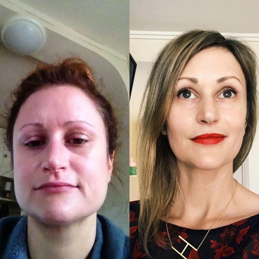 脸浮肿的原因及解决方法,早上起来浮肿怎么快速消肿