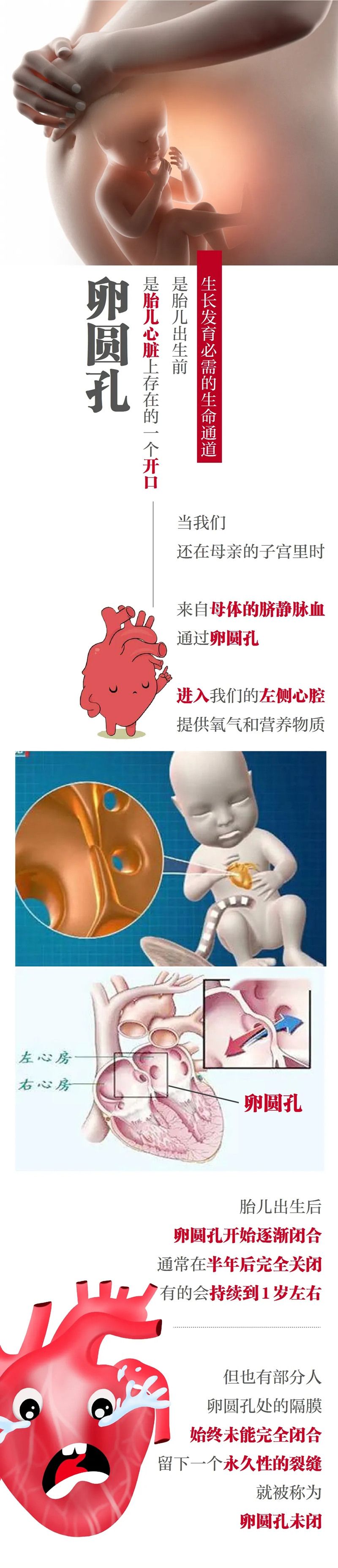 成年人先天性心脏病心脏上有洞,心脏有洞和偏头痛有关系吗