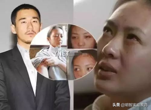 张默吸毒打人,张默吸毒张国立