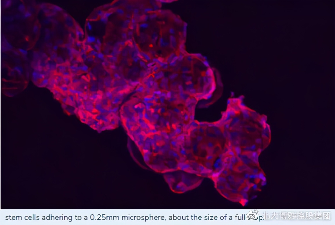 提高心肌收缩能力最好办法,干细胞治疗心脏病最好的医院