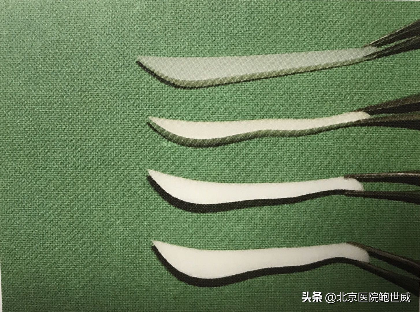 隆鼻后假体外露会有什么表现,假体隆鼻外露怎么修复