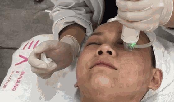 激光美容的12个误区一定要记清,激光美容的正确方法