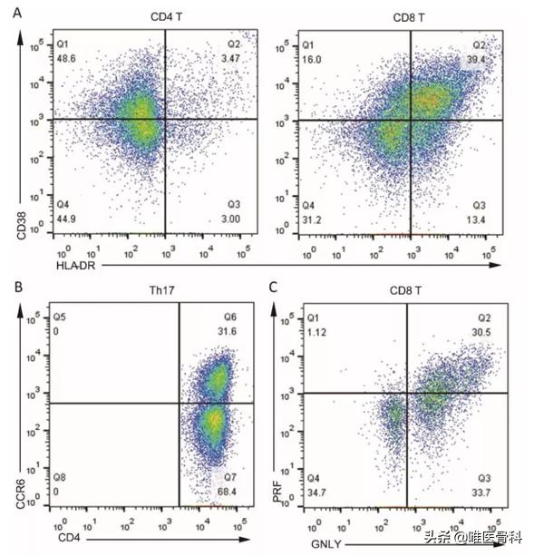 第一例新型冠状病毒遗体解剖真相,新型冠状病毒肺炎人体解剖
