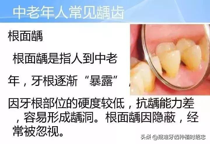 牙齿矫正最佳年龄中年,中年人龅牙可以牙齿矫正吗