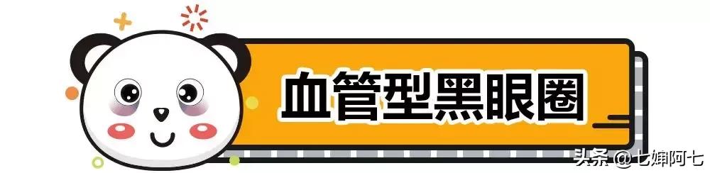 长久都无法消除的黑眼圈,顽固性的黑眼圈要怎么去