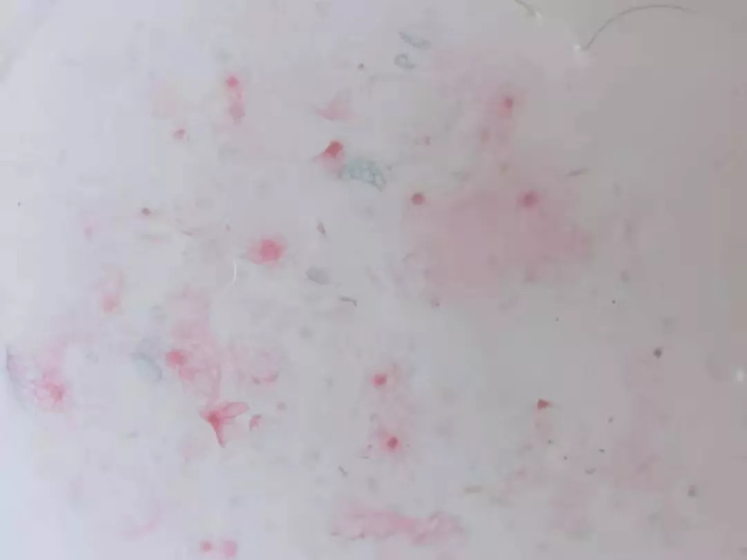 手持式显微镜放大100倍能看清什么,电子数码手机显微镜